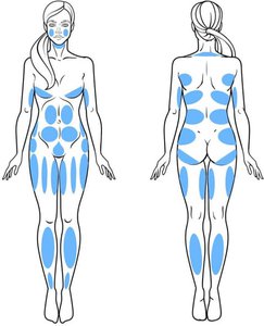Medbelle Areas of Liposuction