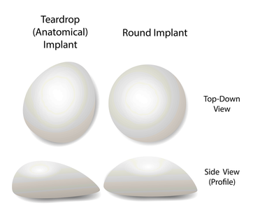 breast implant shapes for breast enlargement and lift